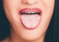 Topografi Lidah (Tongue topografi)