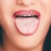 Topografi Lidah (Tongue topografi)